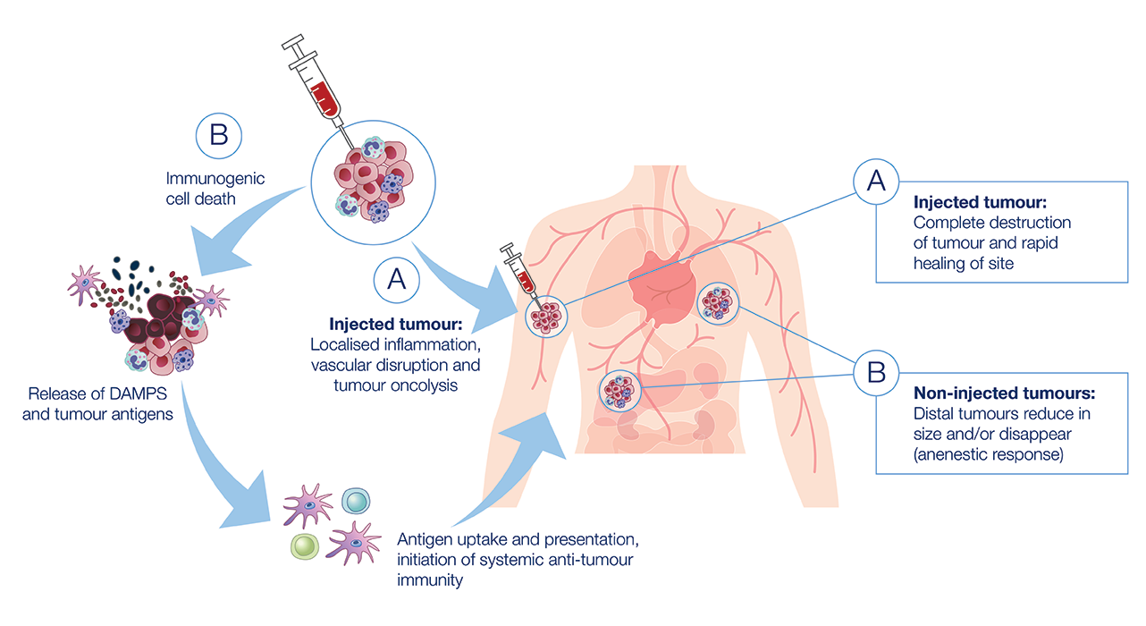 Tigilanol tiglate - Mode of Action